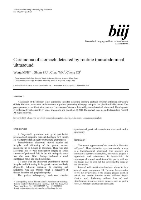 Carcinoma of stomach detected by routine transabdominal ultrasound