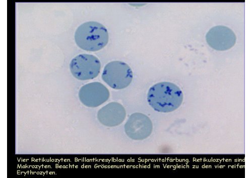 Das normale Blutbild - Hämatologie und Onkologie Rostock