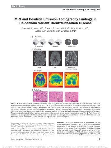 MRI and Positron Emission Tomography Findings in Heidenhain ...