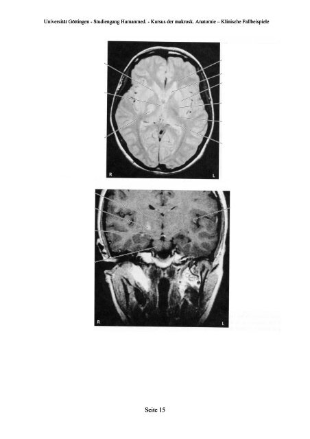 Kursus der Makroskopischen Anatomie