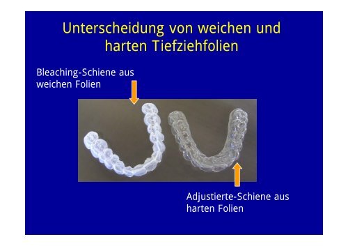 Kurs: Herstellung von Tiefziehschienen