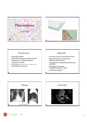 Pleuraerguss PD Dr. J. Leuppi.pdf