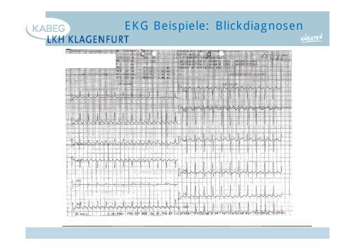 Der atraumatische Thoraxschmerz in der Notfallmedizin