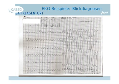 Der atraumatische Thoraxschmerz in der Notfallmedizin