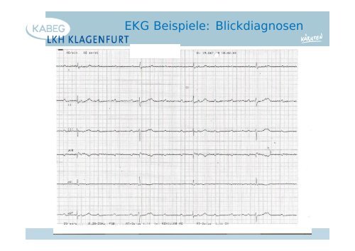 Der atraumatische Thoraxschmerz in der Notfallmedizin