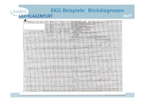 Der atraumatische Thoraxschmerz in der Notfallmedizin