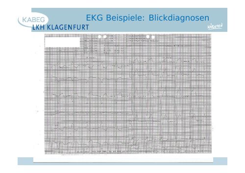 Der atraumatische Thoraxschmerz in der Notfallmedizin