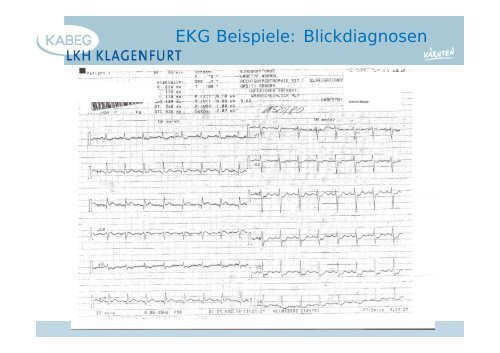 Der atraumatische Thoraxschmerz in der Notfallmedizin