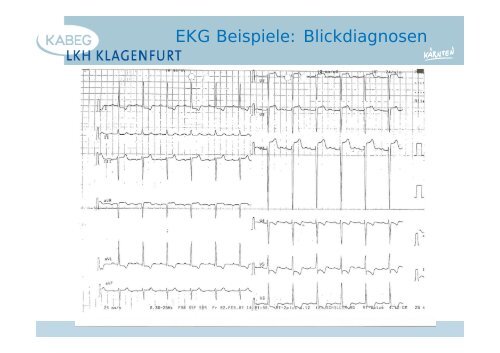 Der atraumatische Thoraxschmerz in der Notfallmedizin