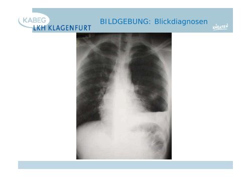 Der atraumatische Thoraxschmerz in der Notfallmedizin