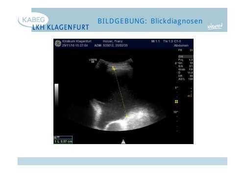 Der atraumatische Thoraxschmerz in der Notfallmedizin