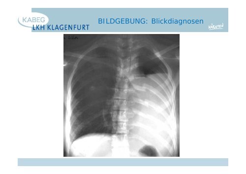 Der atraumatische Thoraxschmerz in der Notfallmedizin