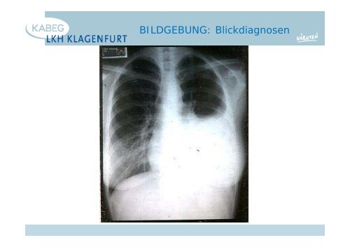 Der atraumatische Thoraxschmerz in der Notfallmedizin