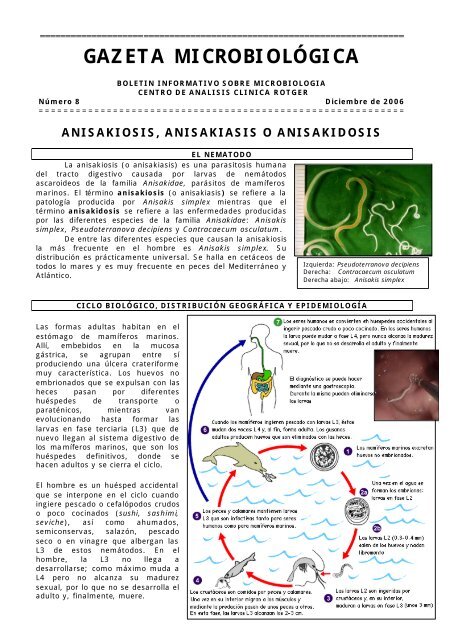 Anisakiosis, anisakiasis o anisakidosis. - Clínica Rotger