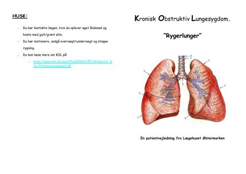 Kronisk Obstruktiv Lungesygdom. - Lægehuset Østermarken