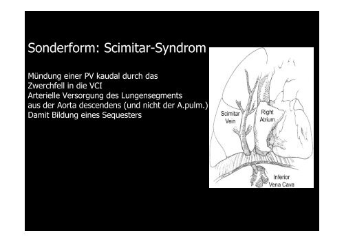 Rezirkulationsvitien - von Torsten Schwalm