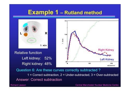 Quantitative Methods in Renography - Nucleus