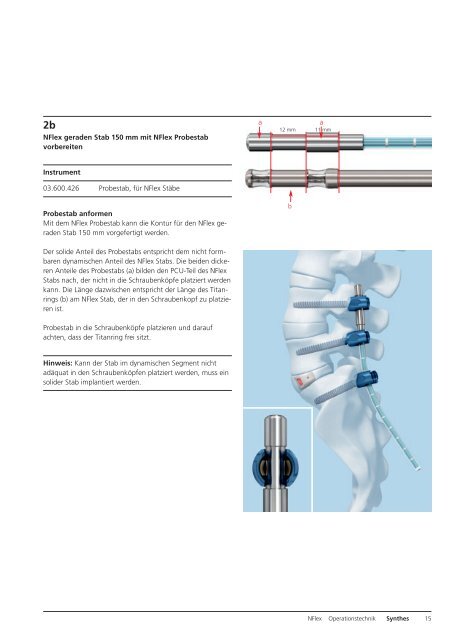 NFlex. Semi-rigide Stäbe für posteriore lumbale ... - Synthes