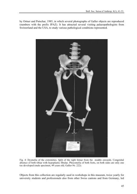 History of the Collection of Physical Anthropology in the Natural ...