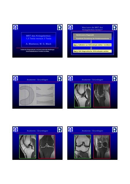 MRT des Kniegelenkes - Institut für Diagnostische und ...