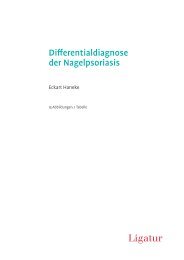 Differentialdiagnose der Nagelpsoriasis - Pierre Fabre Dermatologie