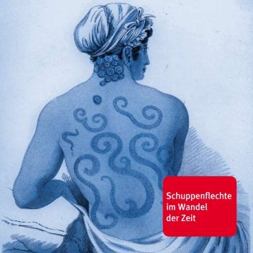 Psoriasis im Wandel - Psorinfo.de