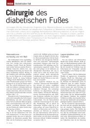 Chirurgie des diabetischen Fußes - AWA