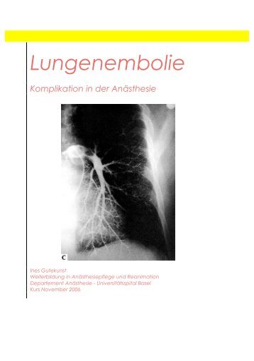 Lungenembolie