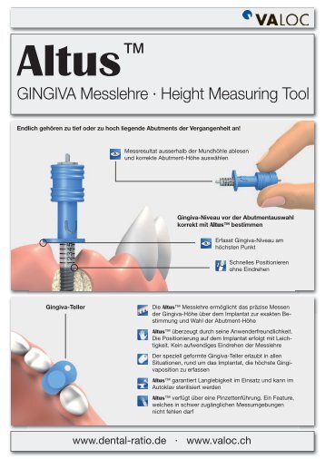 Altus 20130216_web_de - Dental Ratio