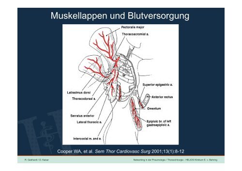 Networking in der Pneumologie / Thoraxchirurgie - Pneumologische ...