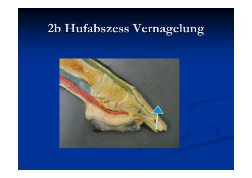 2. Lederhautentzündung wie Steingalle, Abszess...