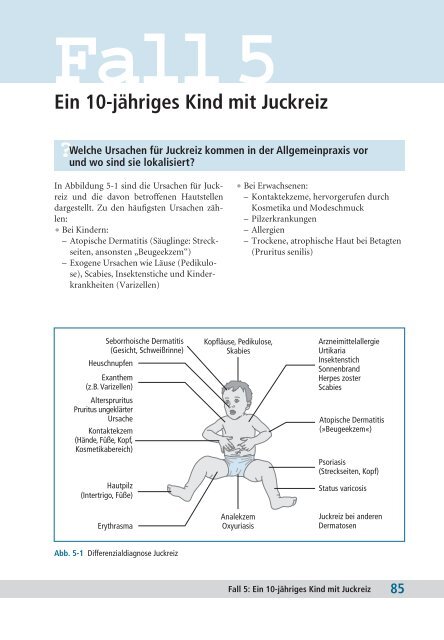 Ein 10-jähriges Kind mit Juckreiz - Schattauer