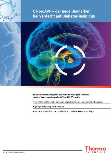 CT-proAVP – der neue Biomarker bei Verdacht auf Diabetes insipidus