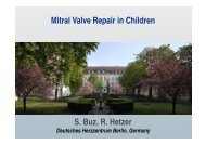 Mitral Valve Repair in Children