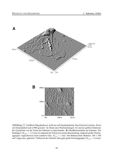 Rasterkraftmikroskopische Untersuchungen an nativen biologischen ...