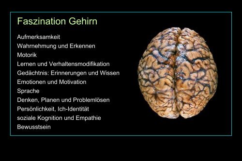 Faszination Gehirn