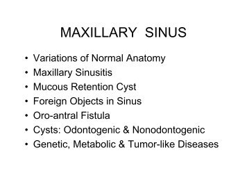 MAXILLARY SINUS