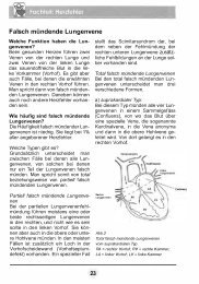 Falsch mündende Lungenvene