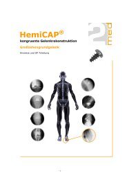 HemiCAP Großzehe klassisch (OP-Anleitung ... - 2MED GmbH