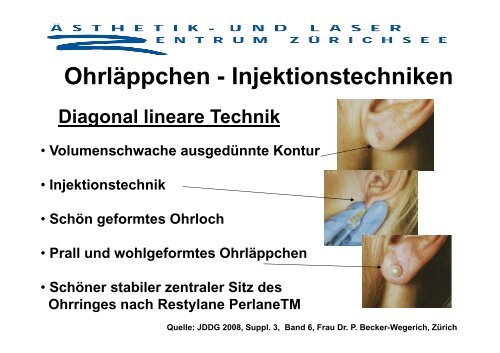 Ohrläppchenrejuvenation mit Restylane Perlane