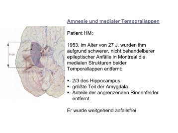 Amnesie und medialer Temporallappen Patient HM: 1953, im Alter ...