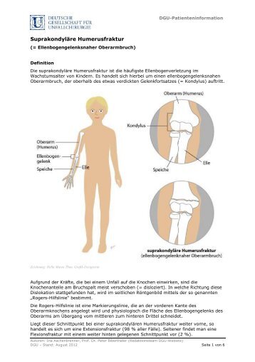 Patienteninformation Suprakonduläre Humeruskopffraktur (PDF)