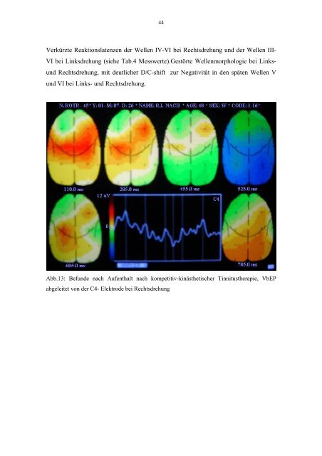 Brain Electrical Activity Mapping vestibulär evozierter Potentiale bei ...