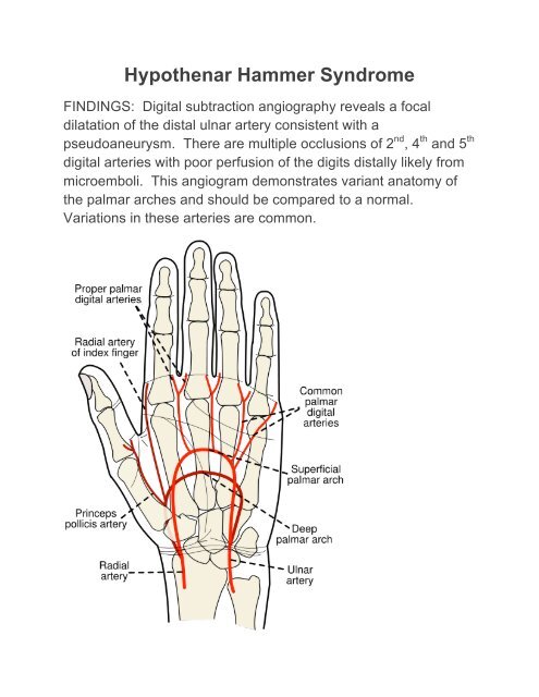 Hypothenar Hammer Syndrome - TrojanImaging.com