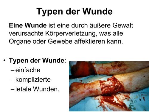 Verschiedene Wundtypen, Grundlagen der Wundversorgung