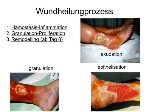 Verschiedene Wundtypen, Grundlagen der Wundversorgung