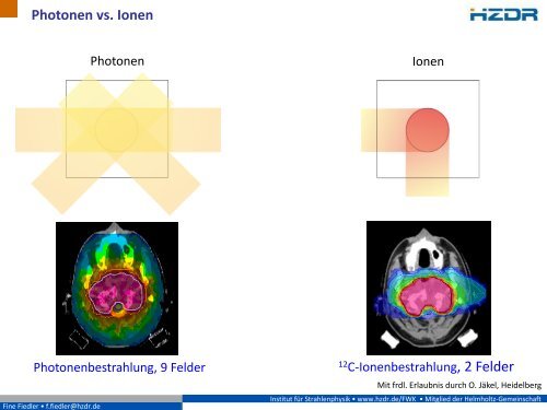 Erfolgreich gegen Krebs - Präzisionsbestrahlungen mit Ionen