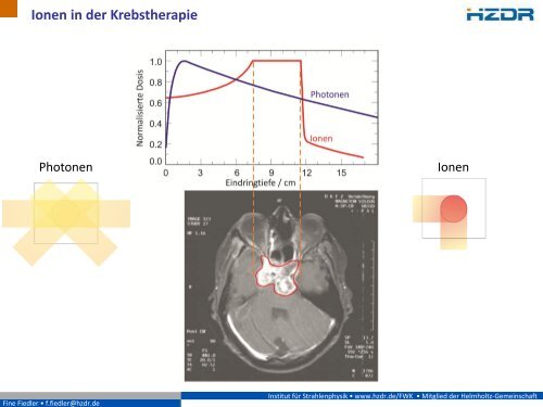 Erfolgreich gegen Krebs - Präzisionsbestrahlungen mit Ionen