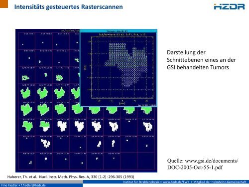 Erfolgreich gegen Krebs - Präzisionsbestrahlungen mit Ionen