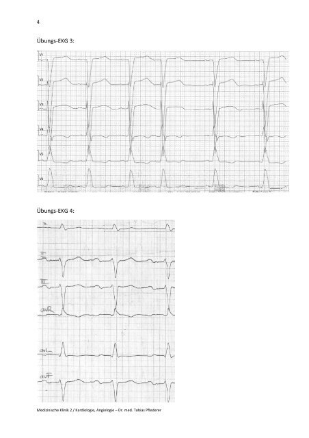 EKG – Schenkelblöcke - Medizin 2